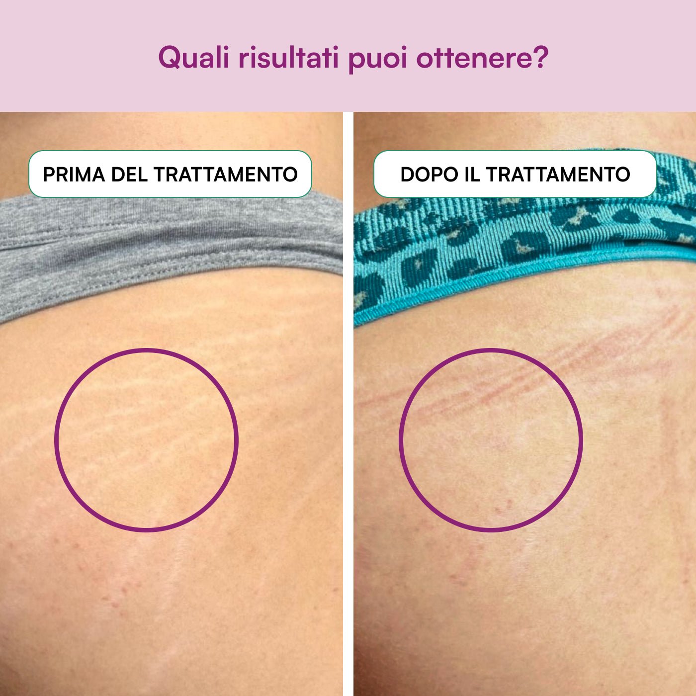 Elasticità e Bellezza