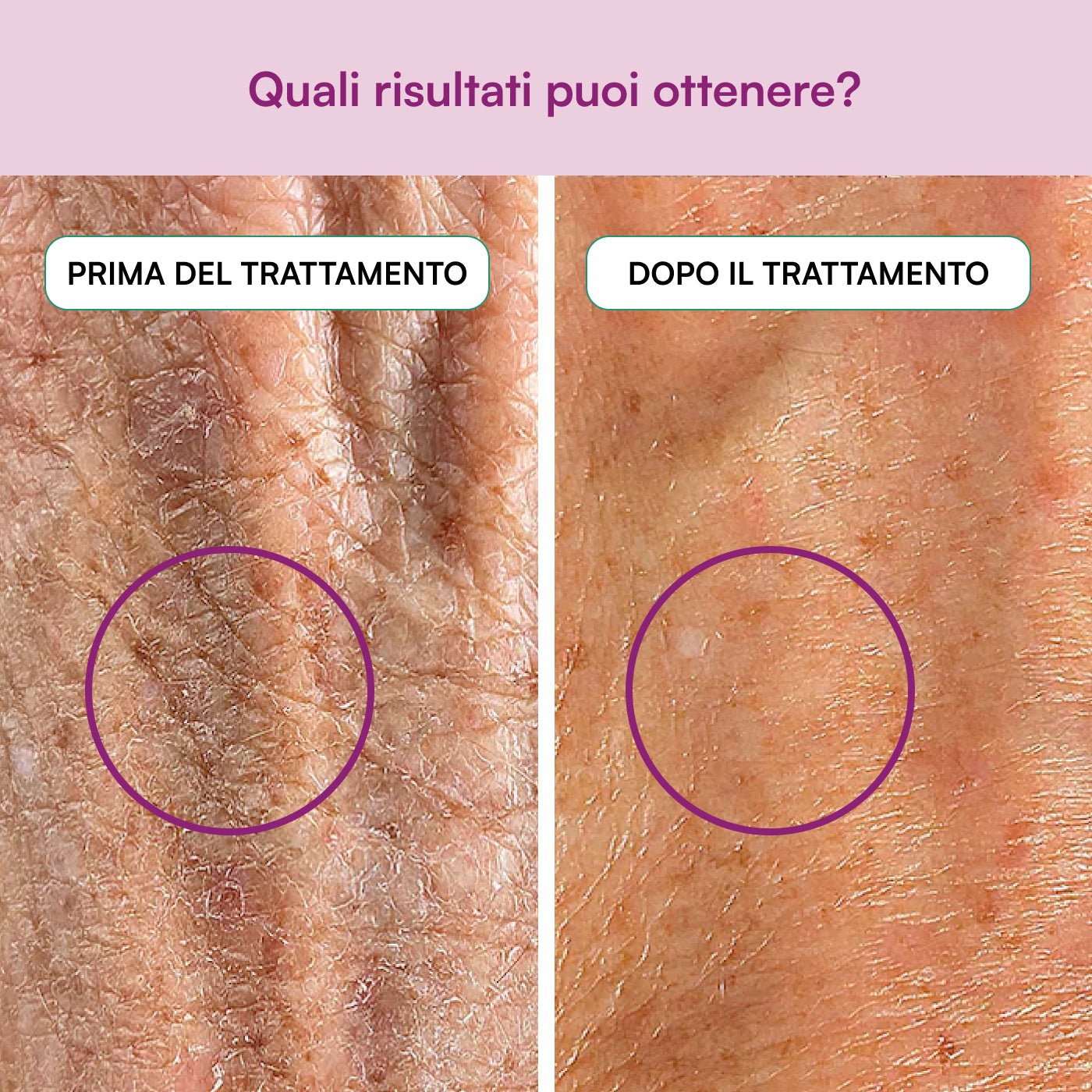 Elasticità e Bellezza