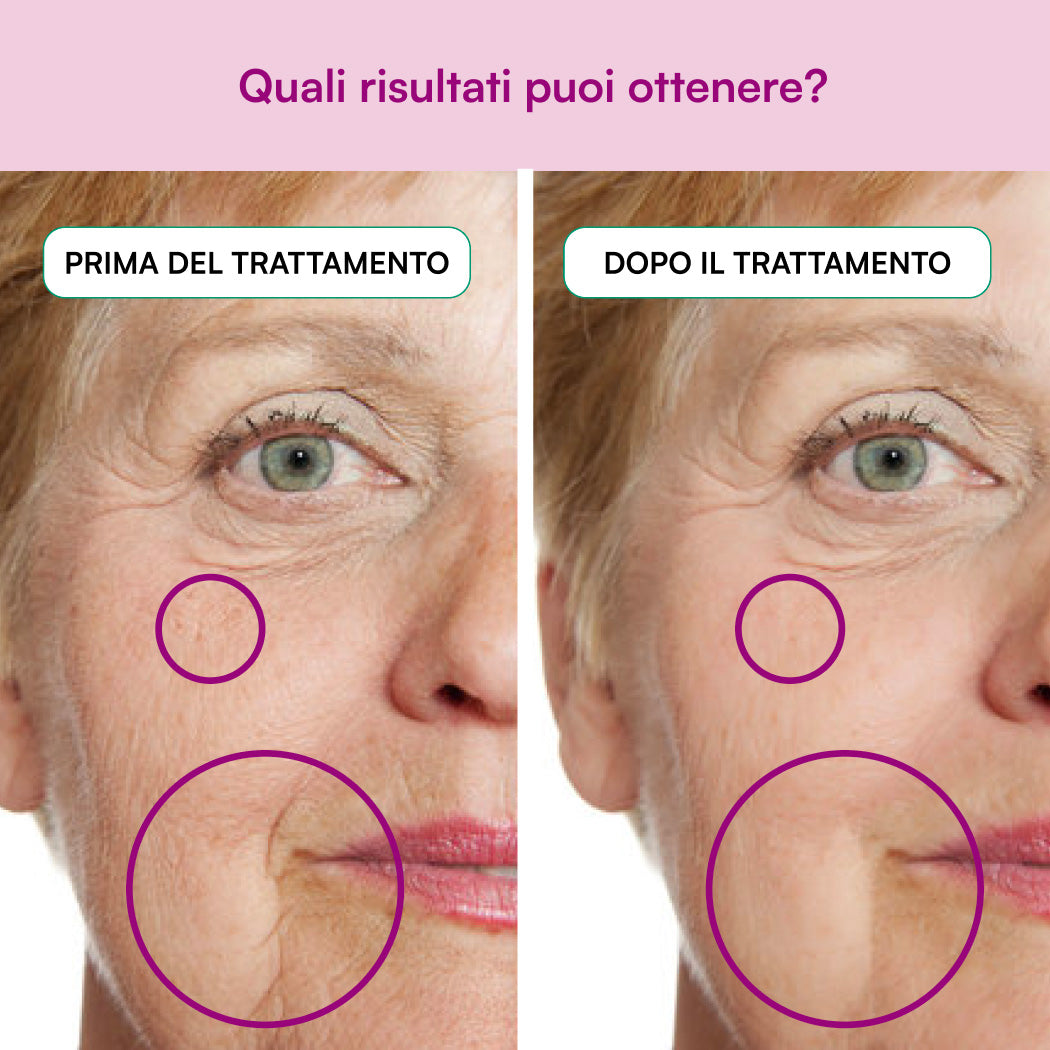 Elasticità e Bellezza