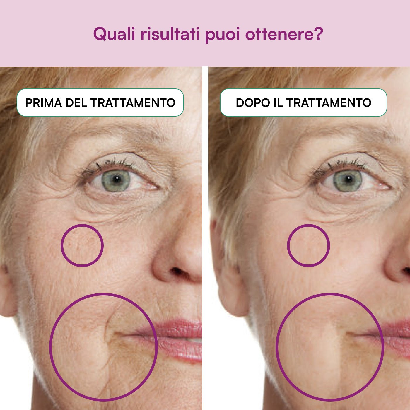 Acido Ialuronico - Naturally